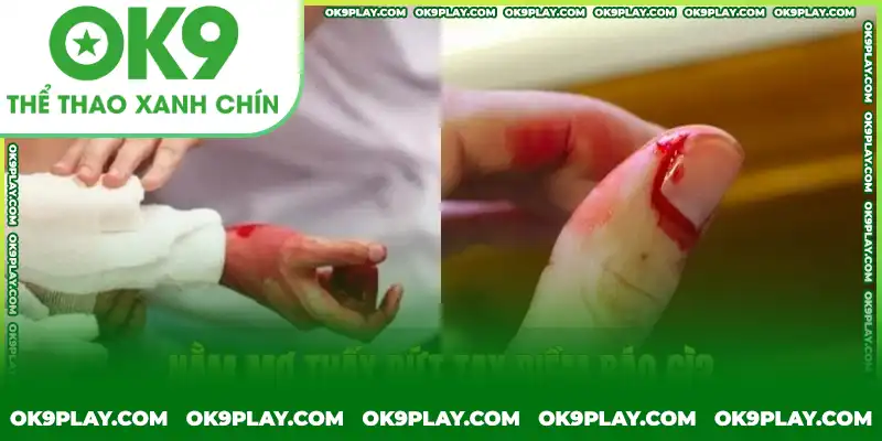 Ý nghĩa khi nằm mơ thấy đứt tay Ý nghĩa khi nằm mơ thấy đứt tay